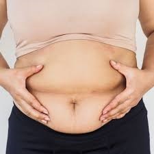woman with belly fat learns the benefits of an alkaline body with baking soda